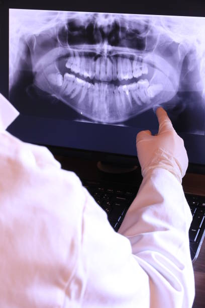 Best Emergency Root Canal Therapy in Fort Pierre, SD